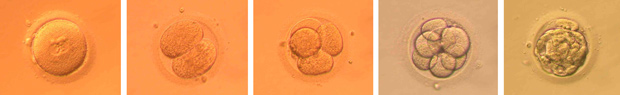 IVF Sarajevo – vantjelesna oplodnja u IVF centru Mehmedbašić